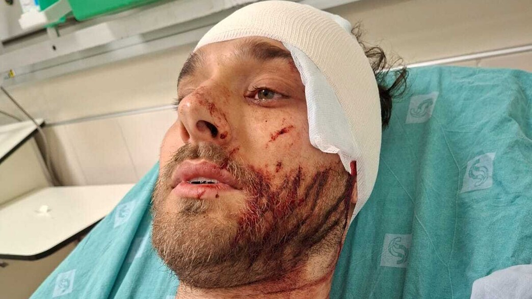 סתיו אשכנזי פצוע לאחר התקיפה