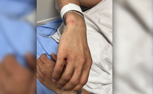 תקיפת ישראלים בקוסמוי, תאילנד