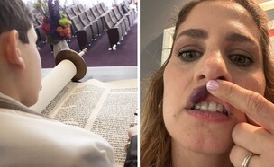 נפגעה מסוכריות (צילום: פרטי)