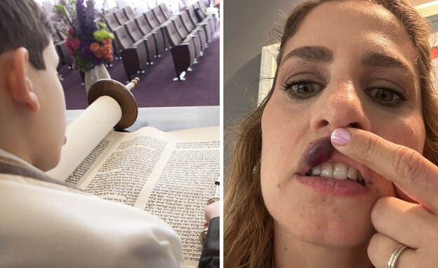 נפגעה מסוכריות