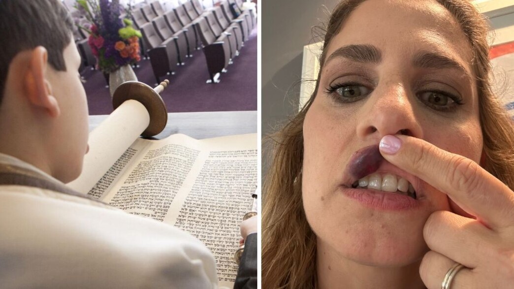 נפגעה מסוכריות נפגעה מסוכריות