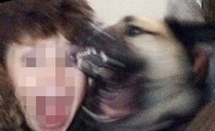 סלפי נשיכה (צילום: Masons)