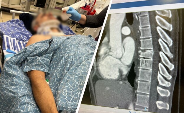 א' שהותקף ברמת גן 