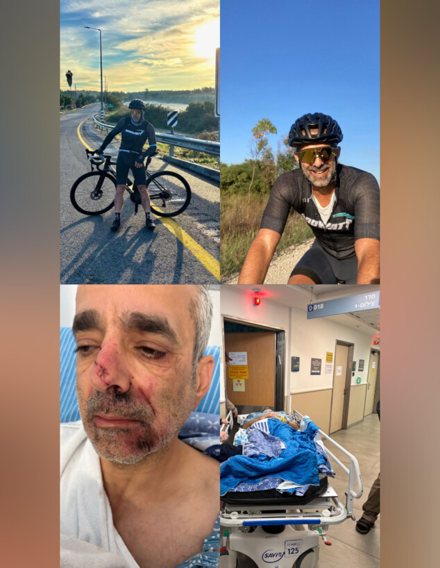 תושב גבעתיים הותקף ע"י נערים בעת שרכב על אופניים