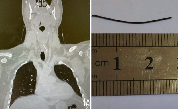 הטונה המסוכנת (צילום: שערי צדק)