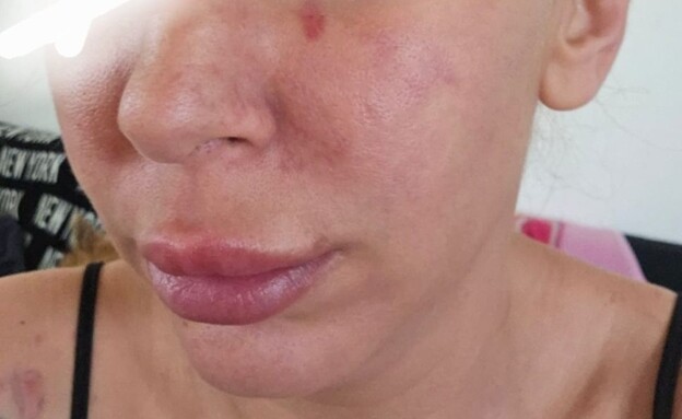 תושבת חדרה שהתלוננה כי הותקפה ע"י קצין משטרה (צילום: פלאשנט חדשות)