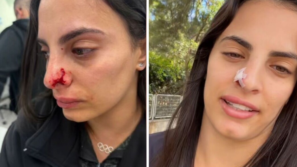 לינוי אשרם תקיפה כלב לינוי אשרם תקיפה כלב