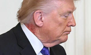 הצוואר של טראמפ (צילום: GETTY IMAGES)