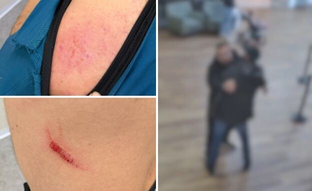 הרופא שהותקף בבאר שבע, תמונה מצילומי האבטחה