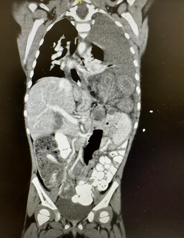 ההדמיה במרכז רפואי צפון (פוריה) ההדמיה במרכז רפואי צפון (פוריה)