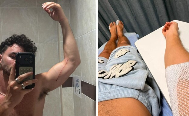 עילי צ'פמן פציעה בתאילנד