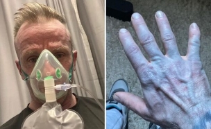 קם בבוקר כחול (צילום: Tommy Lynch, SWNS)