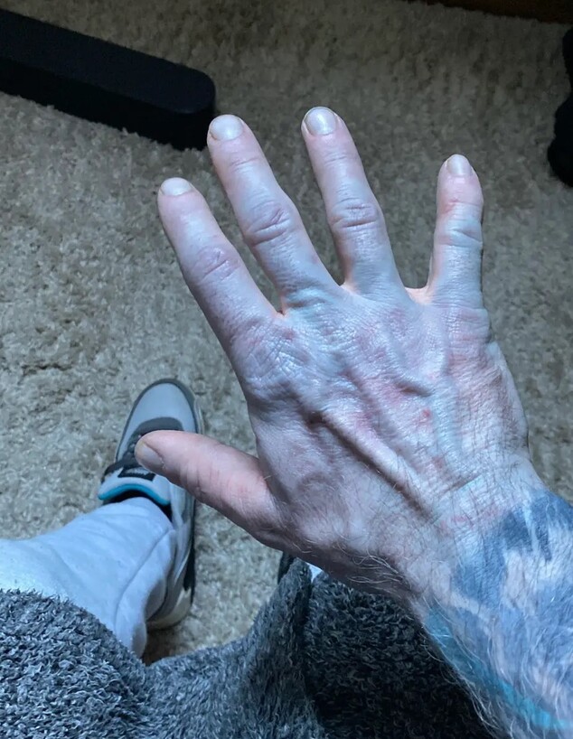 קם בבוקר כחול