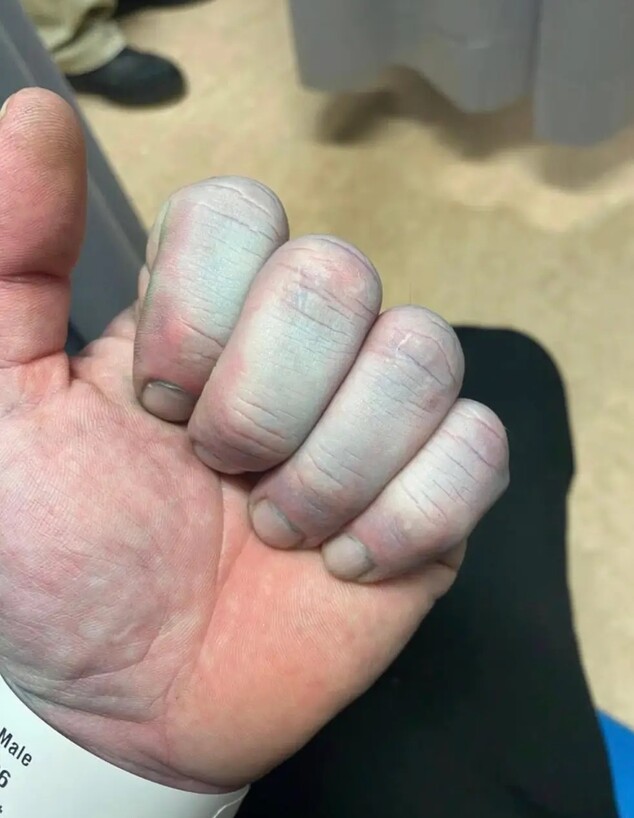 קם בבוקר כחול