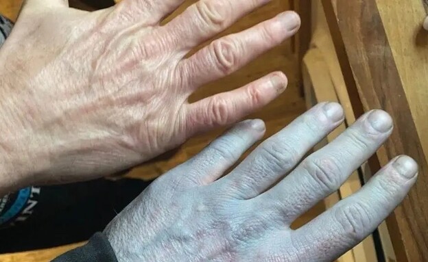 קם בבוקר כחול