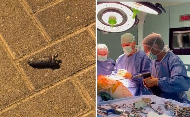 סכנת הפגיעות מרסיסים 