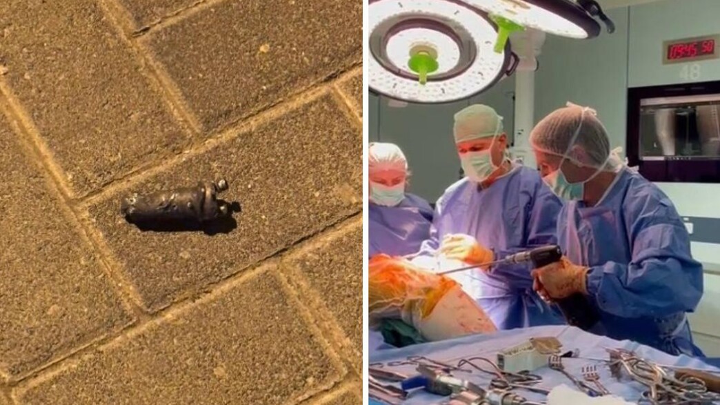 סכנת הפגיעות מרסיסים סכנת הפגיעות מרסיסים