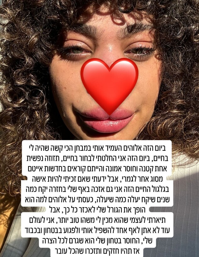 רומי אברג'יל: "מודה על האף שלי ושזכיתי לקבל אותו בחזרה" רומי אברג'יל: "מודה על האף שלי ושזכיתי לקבל אותו בחזרה"