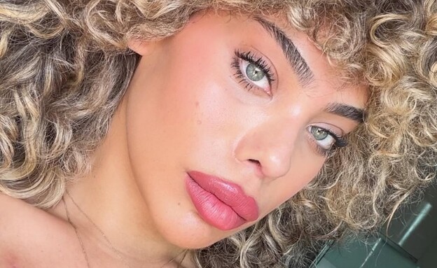 רומי אברג'יל: "מודה על האף שלי ושזכיתי לקבל אותו בחזרה"