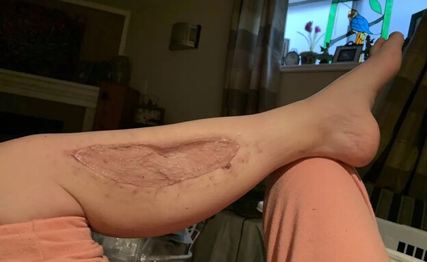 ג׳וליה אנדרסון