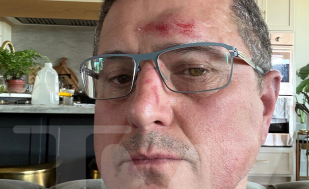 הקורבן לכאורה, לשימוש מוגבל