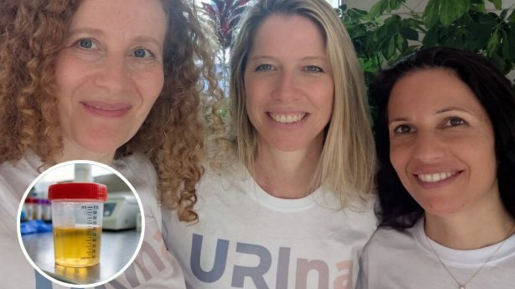 URina, בדיקת שתן URina, בדיקת שתן