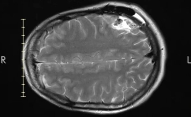 לורן מקפרסון