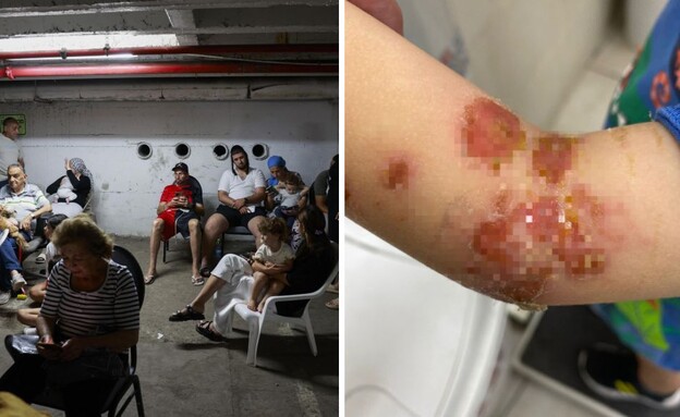 אמפיטיגו במלחמה