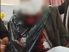 לילה של אלימות בשומרון: קשיש פלסטיני הותקף ליד שכם