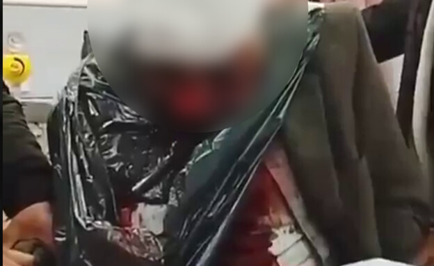 הפלסטיני שטוען שהותקף ע"י מתנחלים (צילום: שימוש לפי סעיף 27א' לחוק זכויות יוצרים)