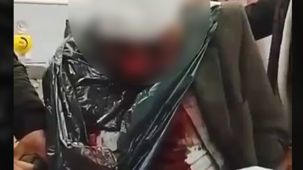 הפלסטיני שטוען שהותקף ע"י מתנחלים הפלסטיני שטוען שהותקף ע"י מתנחלים