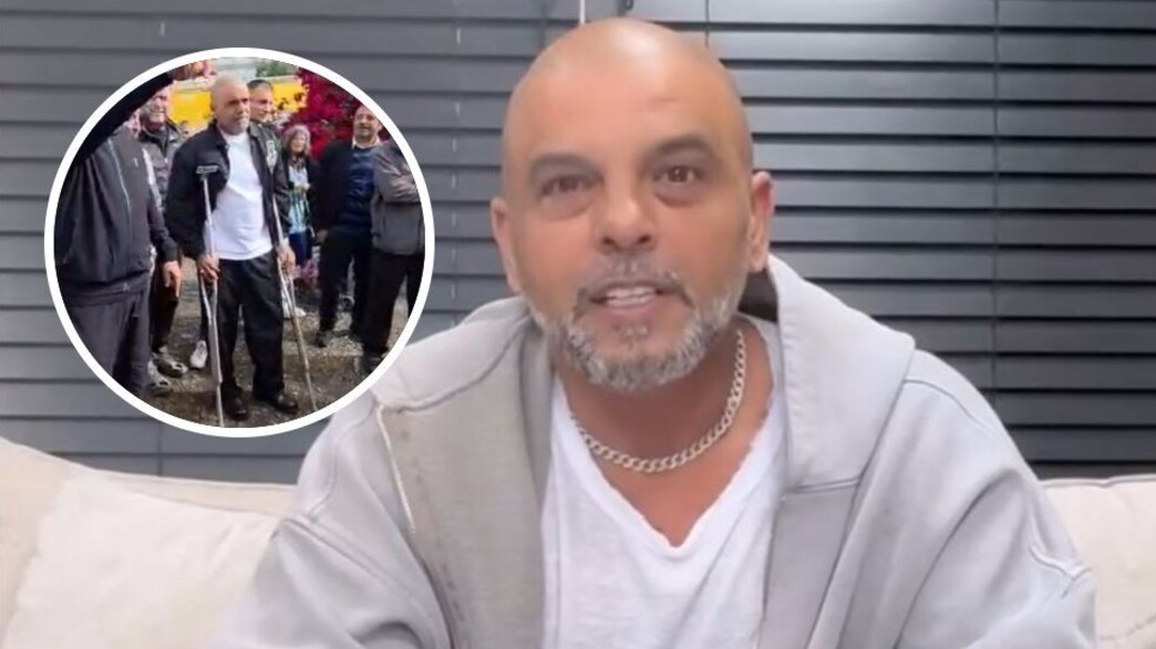 מה קרה שם? זאת הסיבה שאייל גולן מסתובב עם קביים