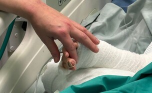 הילד שנפגע אחרי שנפל לתוך סיר מרק רותח