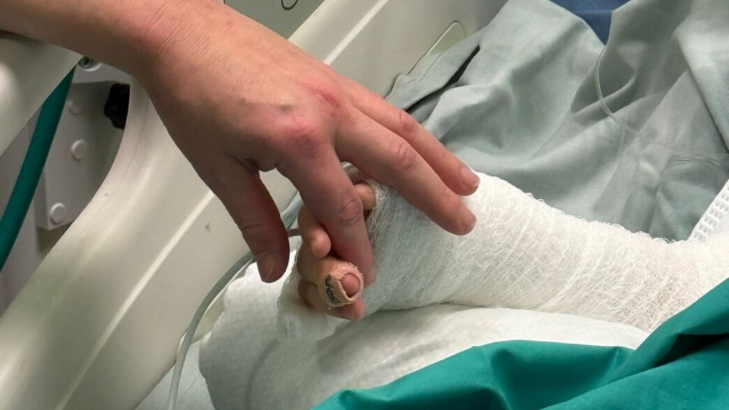 הילד שנפגע אחרי שנפל לתוך סיר מרק רותח הילד שנפגע אחרי שנפל לתוך סיר מרק רותח