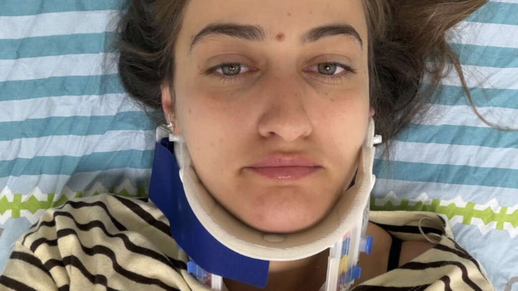 גל מלכה עברה תאונת דרכים