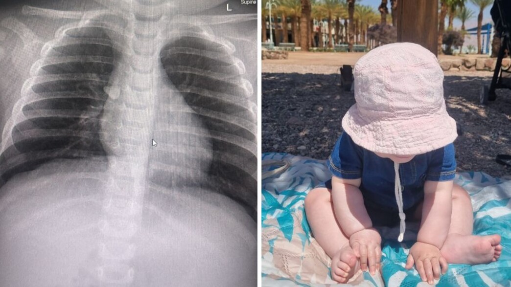 תינוקת שאפה אבן