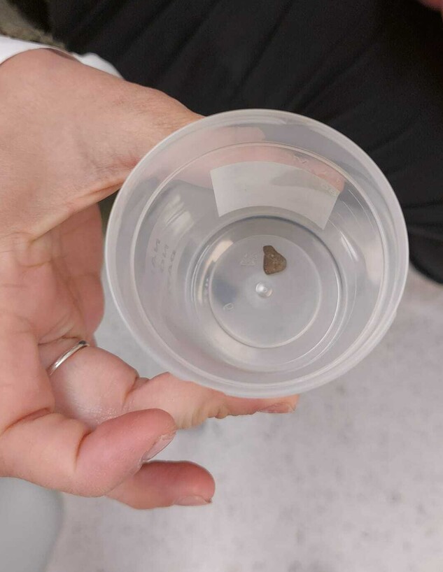 תינוקת שאפה אבן