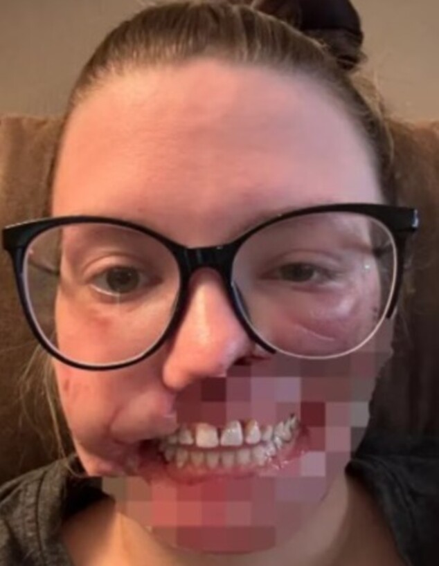 האישה שננשכה האישה שננשכה