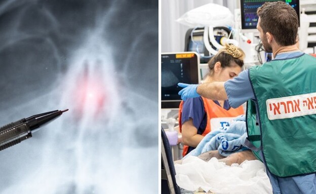 הנזק החמור (צילום: שאטרסטוק)