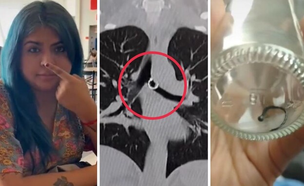 ברחאס (צילום: מתוך הרשתות החברתיות לפי סעיף 27א' לחוק זכויות יוצרים)