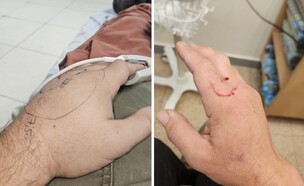 הכשת נחש (צילום: צחי סגל, ראובן אלמלם)