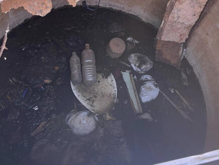 איכס: נפלה לבור שירותים - ונותרה תקועה בתוך צואה במשך שעות