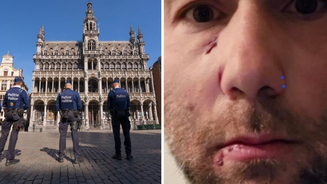 הותקף בבריסל