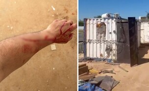 התקיפה באתר הבנייה