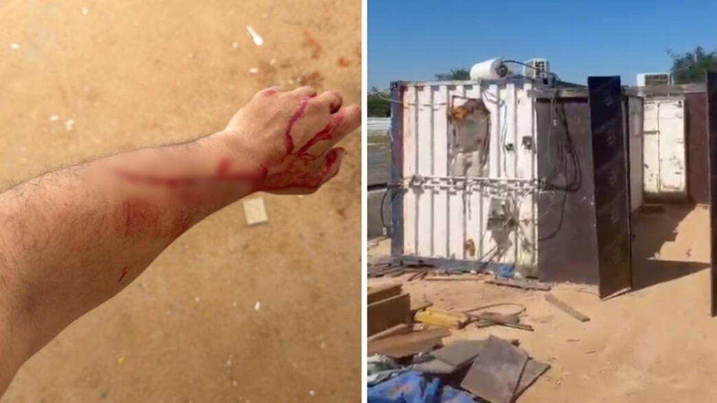 התקיפה באתר הבנייה