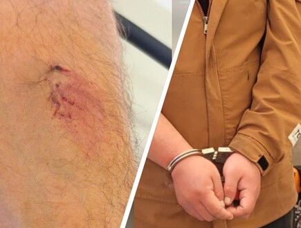 עובד זר מסין ביצע עבירות תנועה, ניסה להימלט - ונשך שוטר 