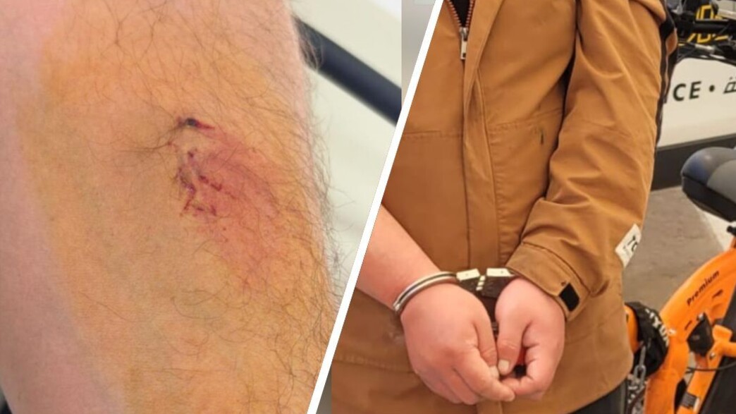 נתין זר נשך שוטר