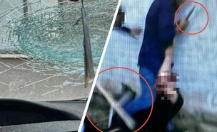 דקרו בעקבות ויכוח על נתיב הכניסה לשכונה (צילום: דוברות המשטרה)