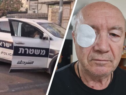 נערים תקפו בן 75 בפארק - התיק נסגר לאחר שלא אותרו: "הכו אותי שוב ושוב, עשו בי לינץ'"