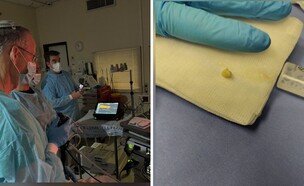 הפרוצדורה בשעצ (צילום: Gorodenkoff, שערי צדק)